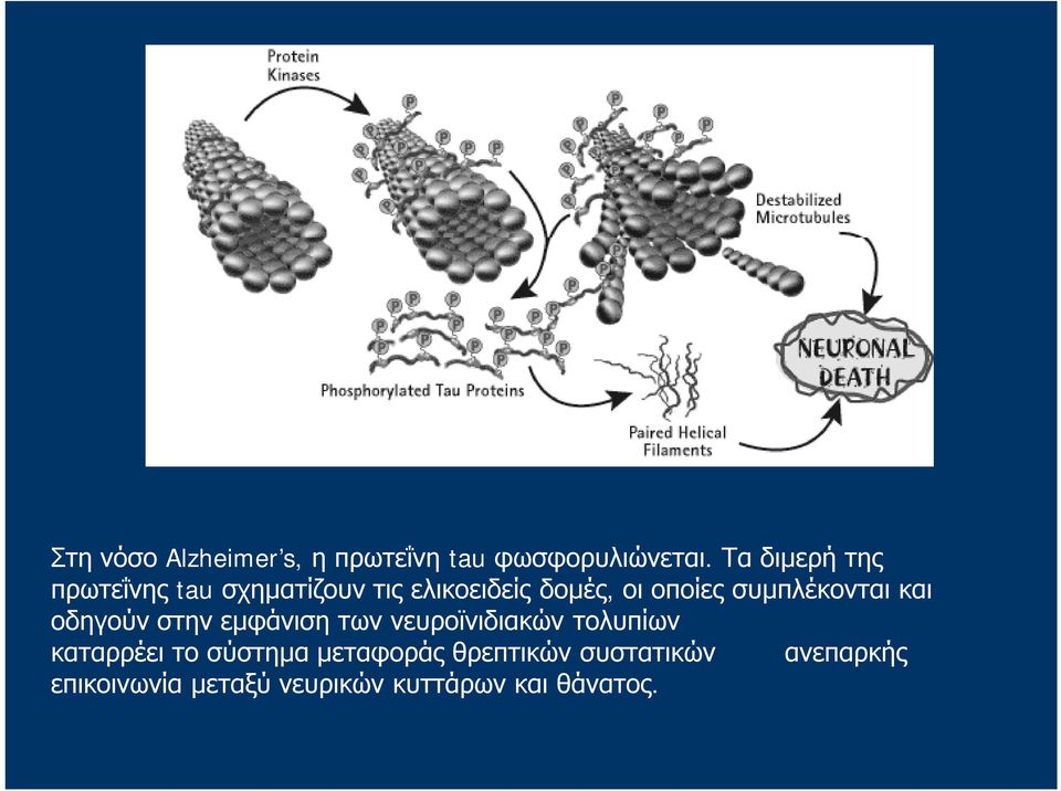 συμπλέκονται και οδηγούν στην εμφάνιση των νευροϊνιδιακών τολυπίων καταρρέει