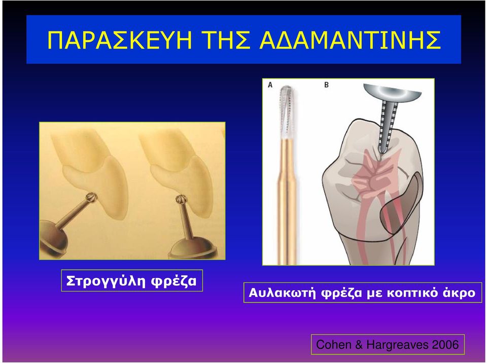 φρέζα Αυλακωτή φρέζα με