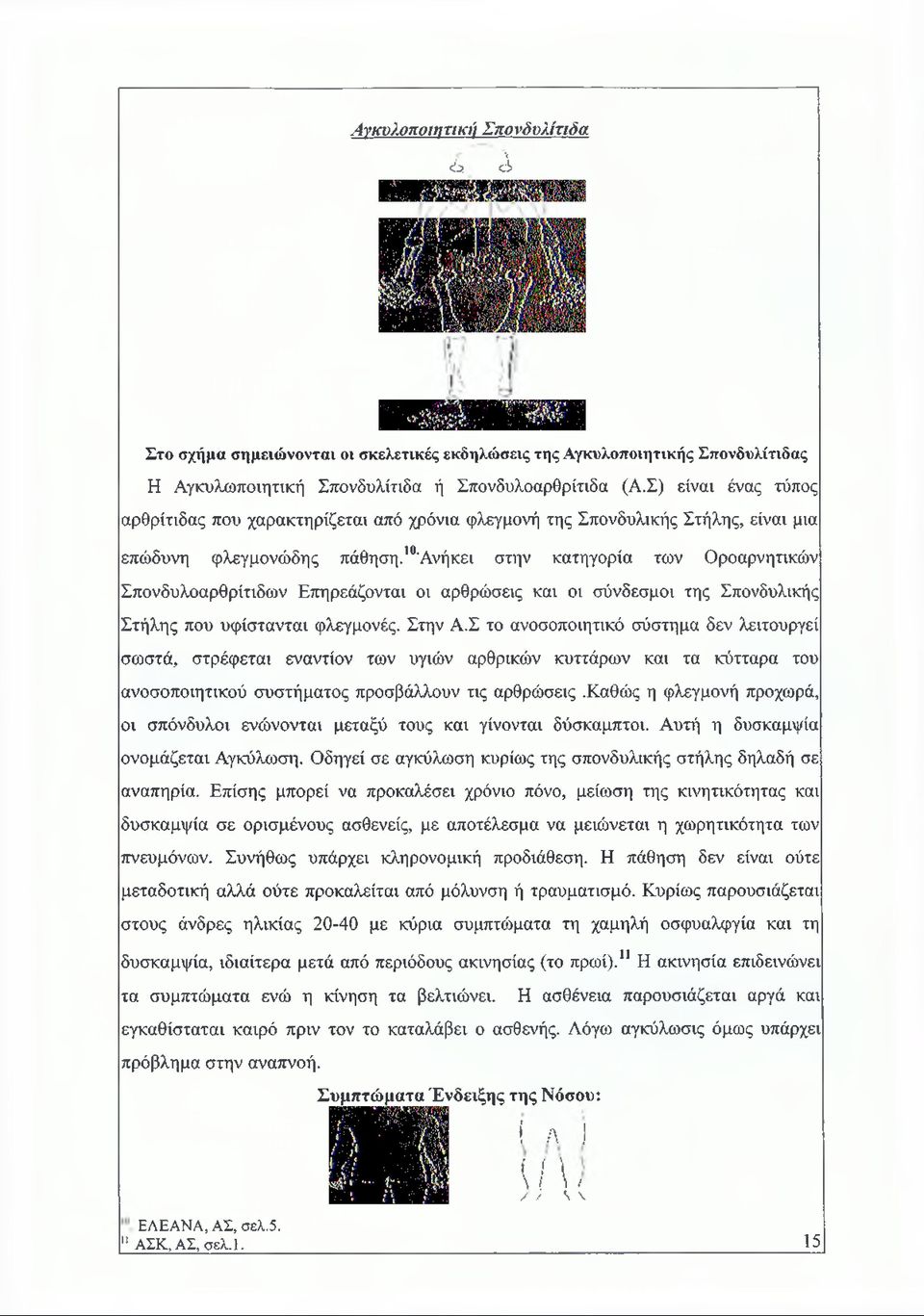 10άνήκει στην κατηγορία των Οροαρνητικών Σπονδυλοαρθρίτιδων Επηρεάζονται οι αρθρώσεις και οι σύνδεσμοι της Σπονδυλικής Στήλης που υφίστανται φλεγμονές. Στην Α.