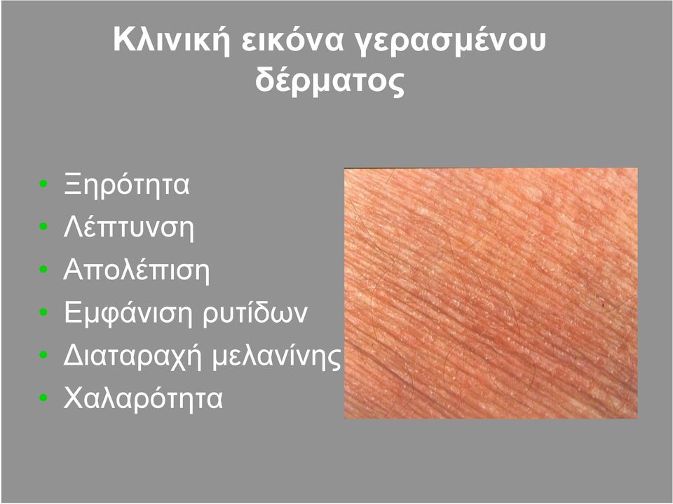 Απολέπιση Εµφάνιση ρυτίδων