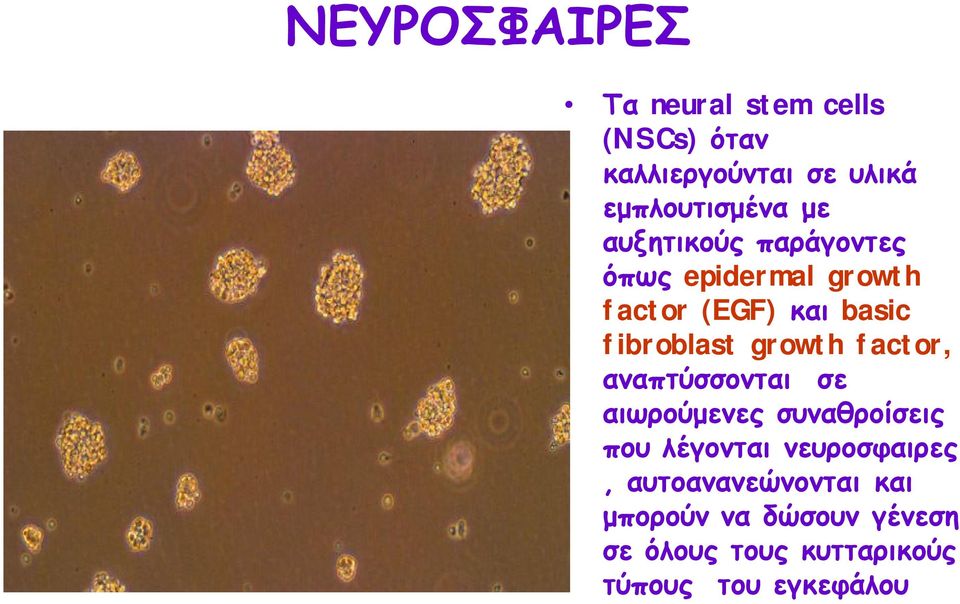 growth factor, αναπτύσσονται σε αιωρούμενες συναθροίσεις που λέγονται νευροσφαιρες,