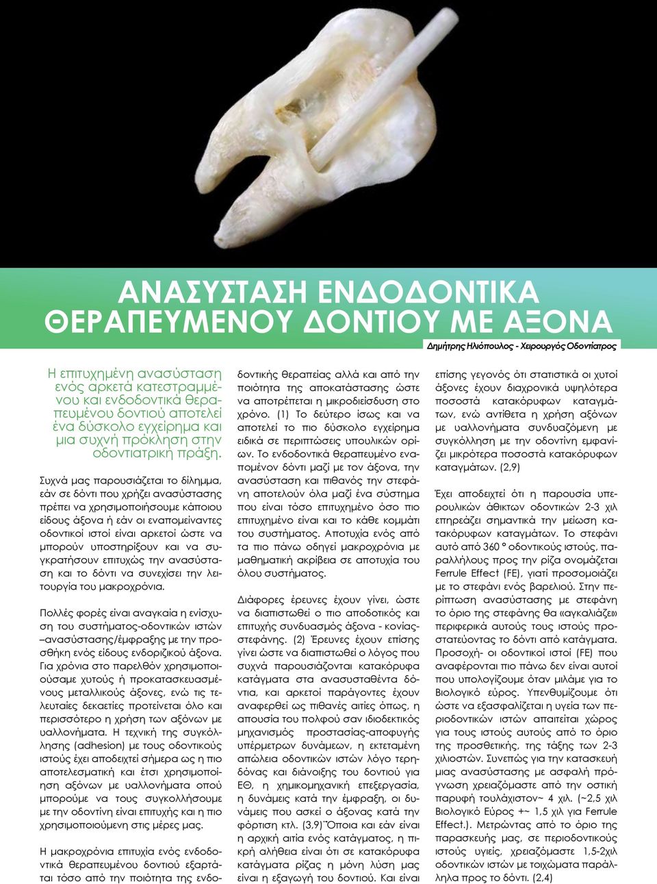 Συχνά μας παρουσιάζεται το δίλημμα, εάν σε δόντι που χρήζει ανασύστασης πρέπει να χρησιμοποιήσουμε κάποιου είδους άξονα ή εάν οι εναπομείναντες οδοντικοί ιστοί είναι αρκετοί ώστε να μπορούν