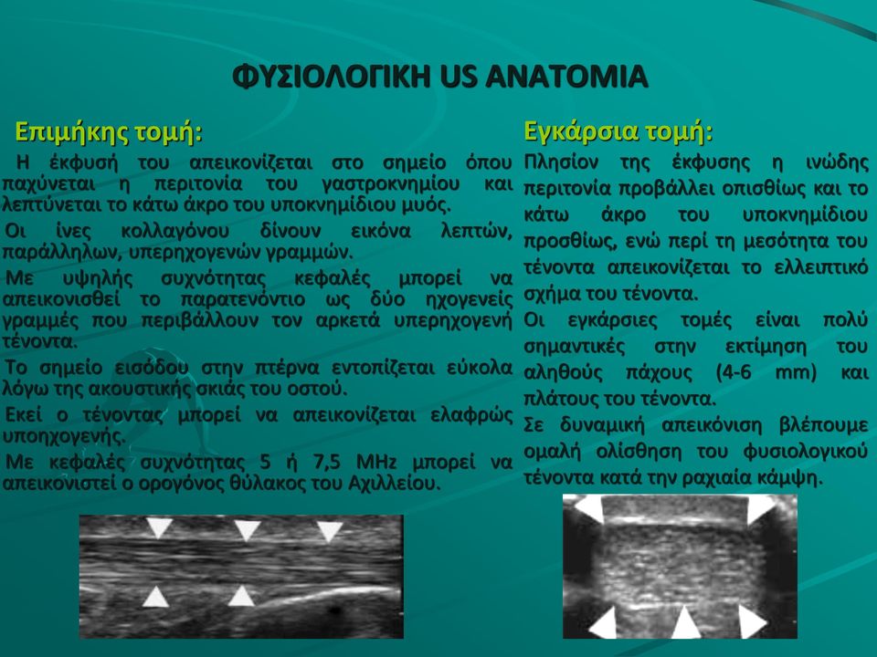 Με υψηλής συχνότητας κεφαλές μπορεί να απεικονισθεί το παρατενόντιο ως δύο ηχογενείς γραμμές που περιβάλλουν τον αρκετά υπερηχογενή τένοντα.