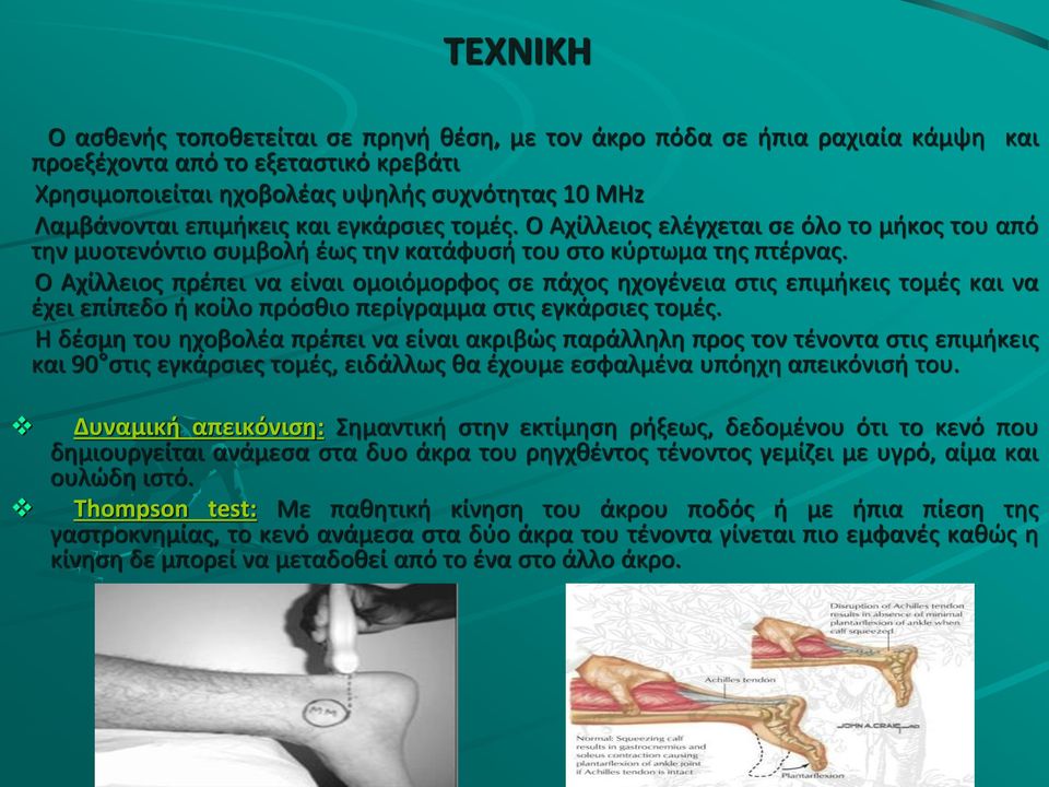 Ο Αχίλλειος πρέπει να είναι ομοιόμορφος σε πάχος ηχογένεια στις επιμήκεις τομές και να έχει επίπεδο ή κοίλο πρόσθιο περίγραμμα στις εγκάρσιες τομές.