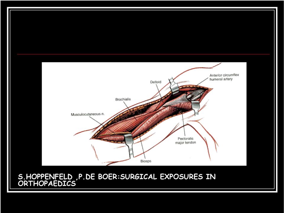 BOER:SURGICAL