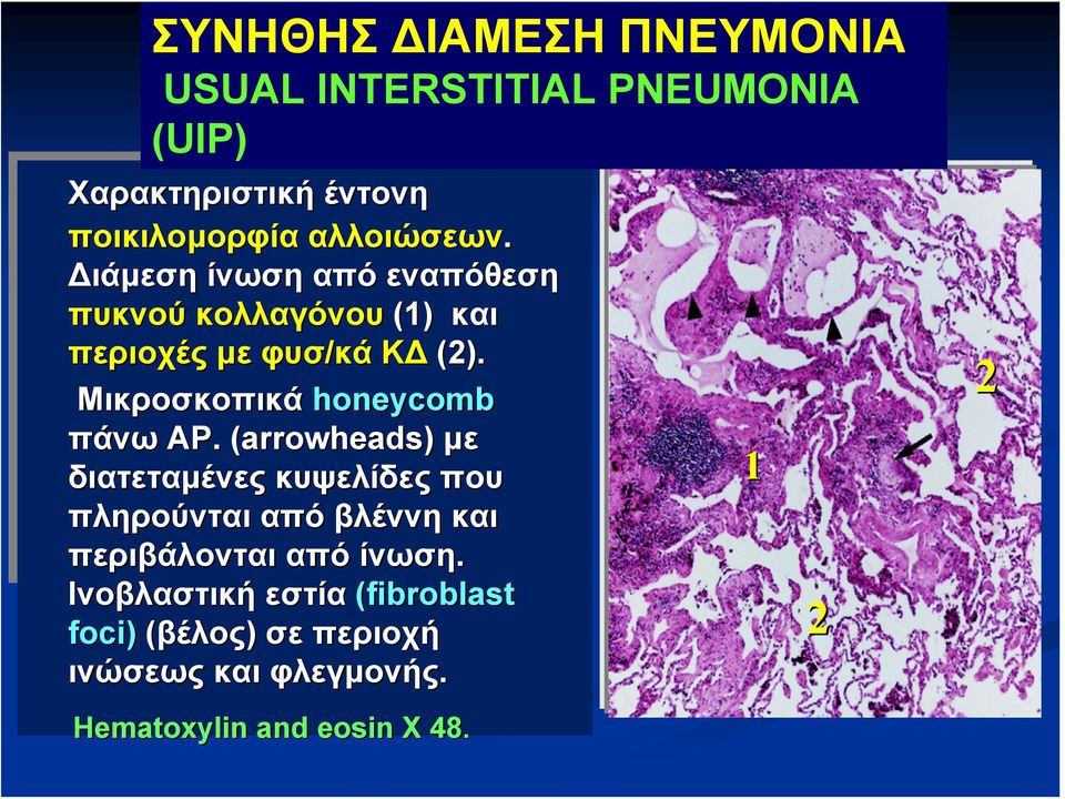 Mικροσκοπικά honeycomb πάνω ΑΡ.