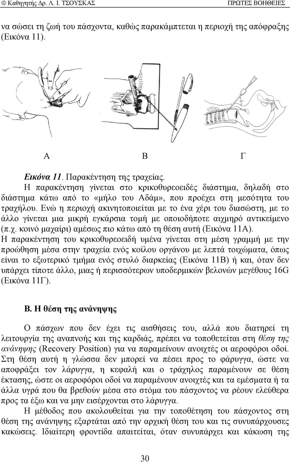 Ενώ η περιοχή ακινητοποιείται µε το ένα χέρι του διασώστη, µε το άλλο γίνεται µια µικρή εγκάρσια τοµή µε οποιοδήποτε αιχµηρό αντικείµενο (π.χ. κοινό µαχαίρι) αµέσως πιο κάτω από τη θέση αυτή (Εικόνα 11Α).