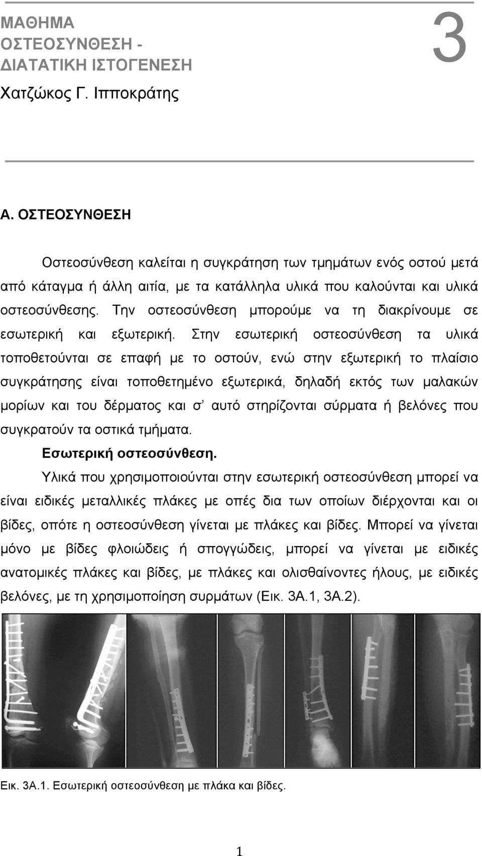 Την οστεοσύνθεση µπορούµε να τη διακρίνουµε σε εσωτερική και εξωτερική.