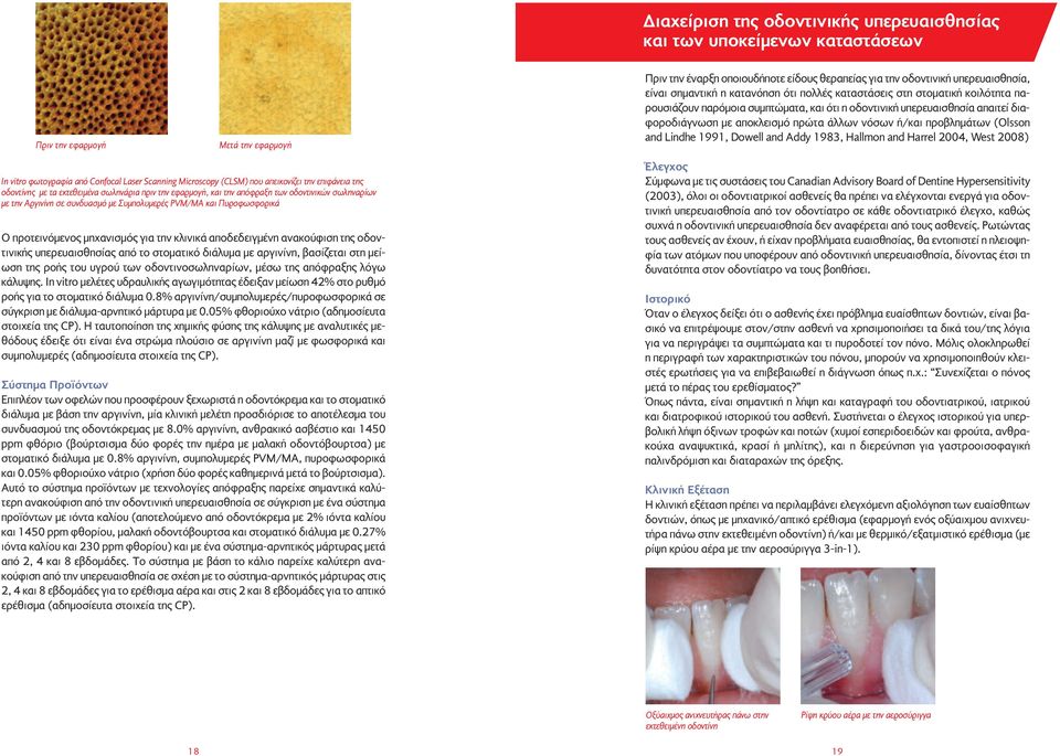 ή/και προβλημάτων (Olsson and Lindhe 1991, Dowell and Addy 1983, Hallmon and Harrel 2004, West 2008) In vitro φωτογραφία από Confocal Laser Scanning Microscopy (CLSM) που απεικονίζει την επιφάνεια