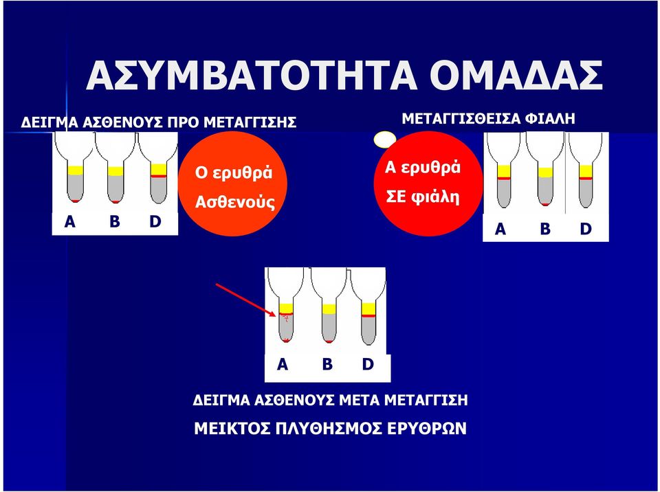 Αερυθρά A B D Ασθενούς ΣΕ φιάλη A B D A B D
