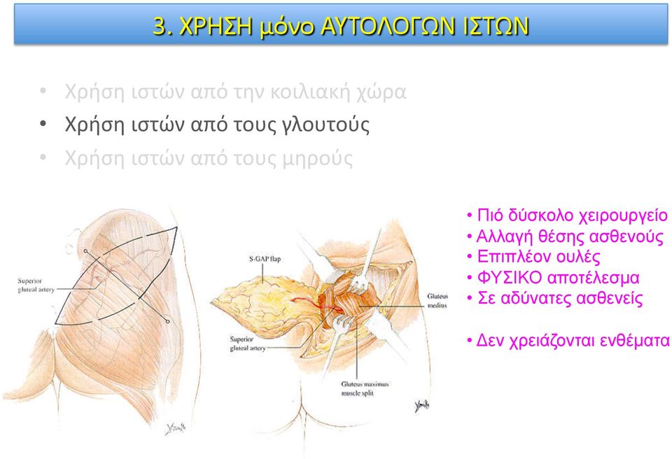 χειρουργείο Αλλαγή θέσης ασθενούς Επιπλέον ουλές