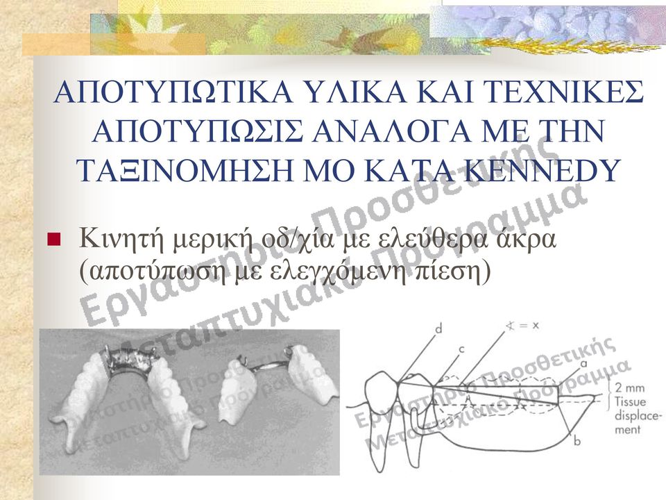 ΜΟ ΚΑTA ΚΕΝΝΕDY Κινητή μερική οδ/χία