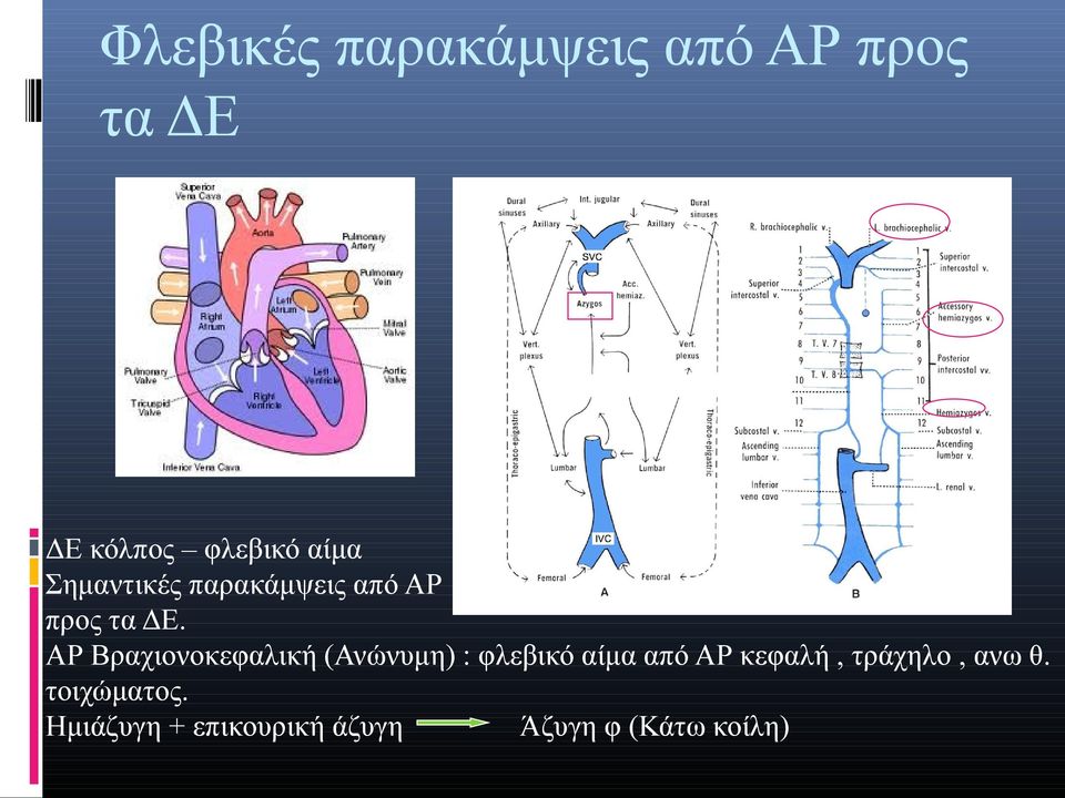 ΑΡ Βραχιονοκεφαλική (Ανώνυμη) : φλεβικό αίμα από ΑΡ κεφαλή,