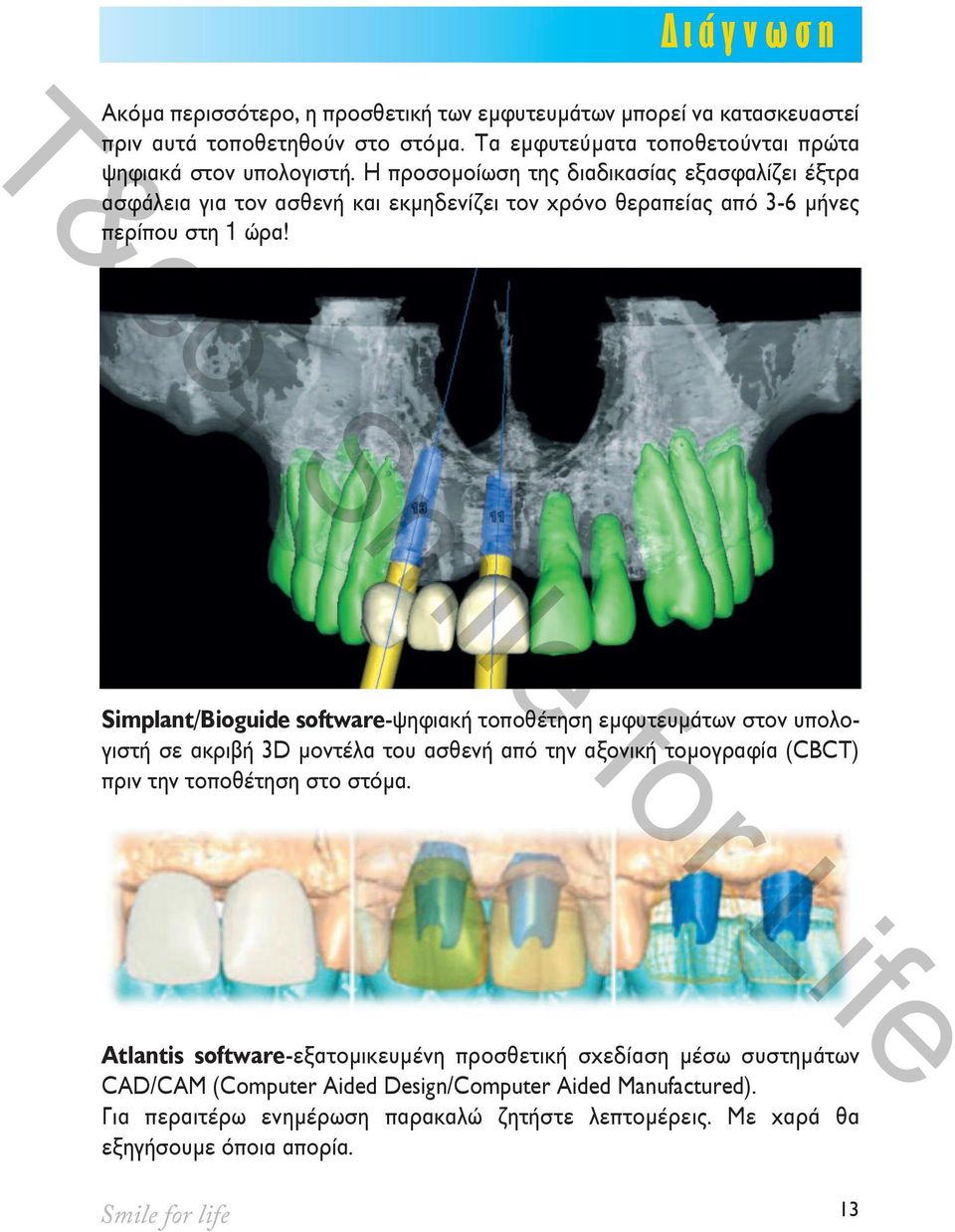Simplant/Bioguide software-ψηφιακή τοποθέτηση εμφυτευμάτων στον υπολογιστή σε ακριβή 3D μοντέλα του ασθενή από την αξονική τομογραφία (CBCT) πριν την τοποθέτηση στο στόμα.