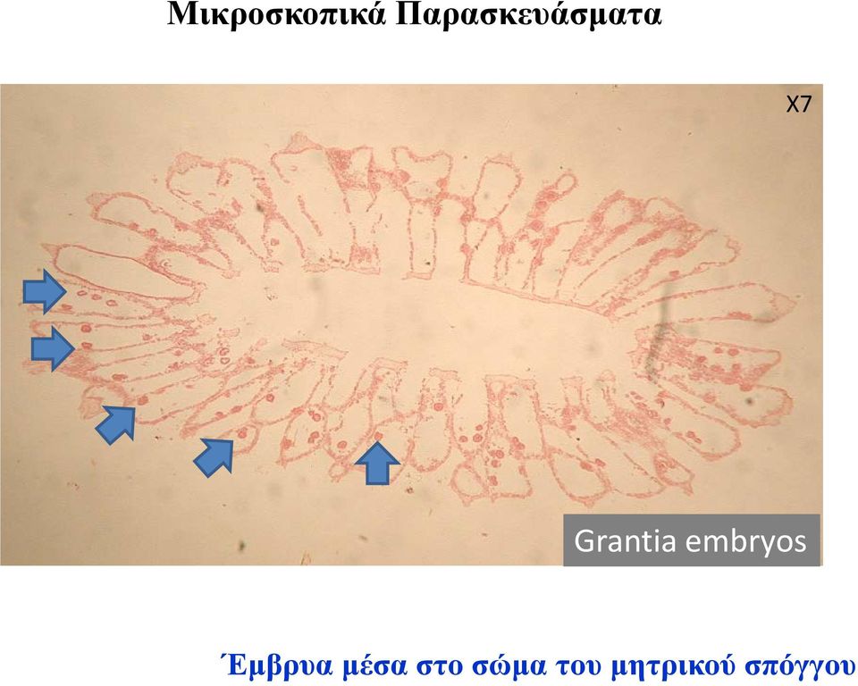 Grantia embryos