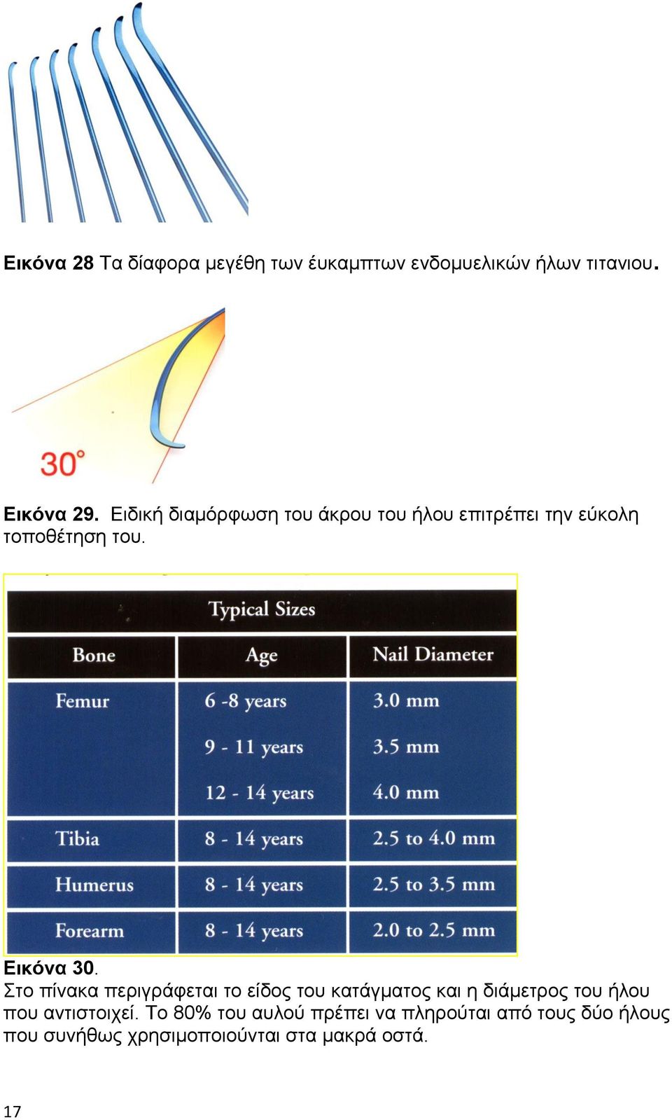 Στο πίνακα περιγράφεται το είδος του κατάγματος και η διάμετρος του ήλου που αντιστοιχεί.