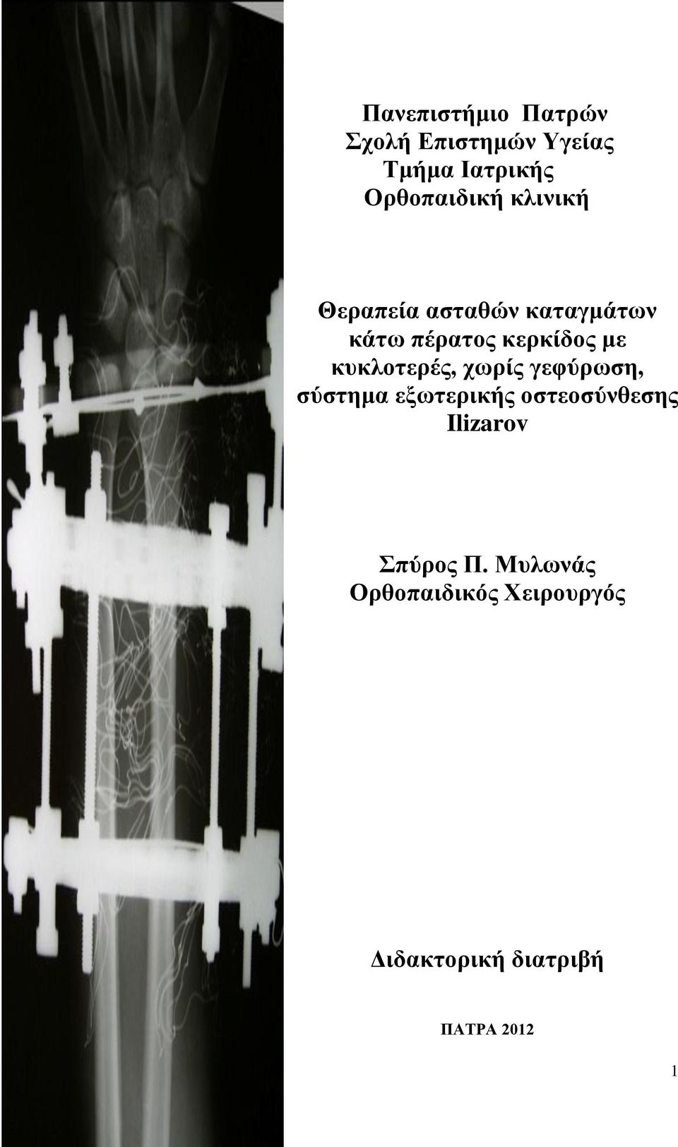 κερκίδος με κυκλοτερές, χωρίς γεφύρωση, σύστημα εξωτερικής
