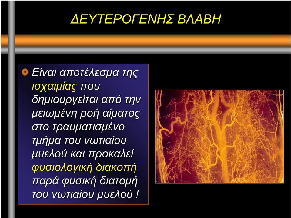 τραυµατισµένο τµήµα τουνωτιαίου µυελού και προκαλεί