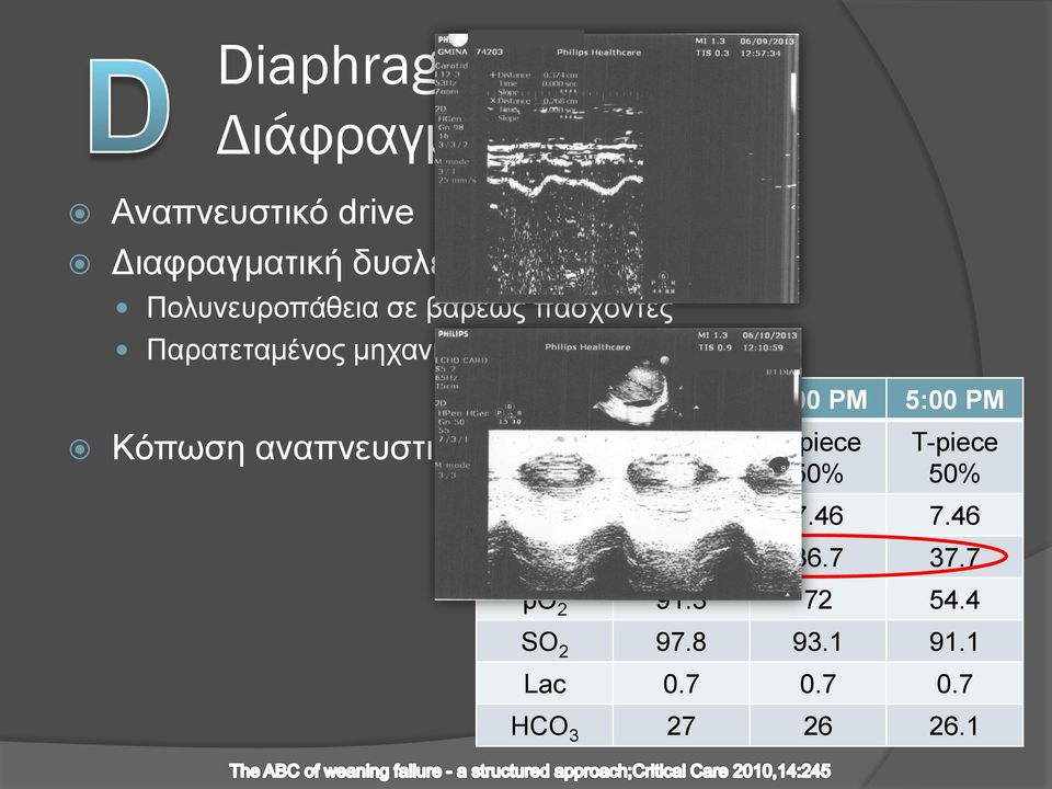 Μέθοδος 10:00 AM 3:00 PM 5:00 PM SPONT T-piece 50% T-piece 50% ph 7.48 7.46 7.