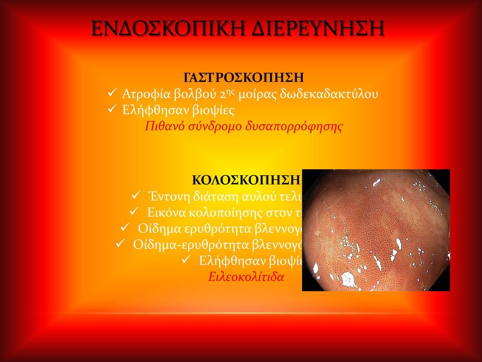 αυλού τελικού ειλεού Εικόνα κολοποίησης στον τελικό ειλεό Οίδημα ερυθρότητα