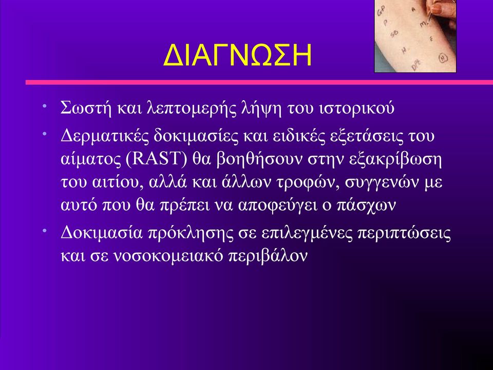 αιτίου, αλλά και άλλων τροφών, συγγενών με αυτό που θα πρέπει να αποφεύγει ο