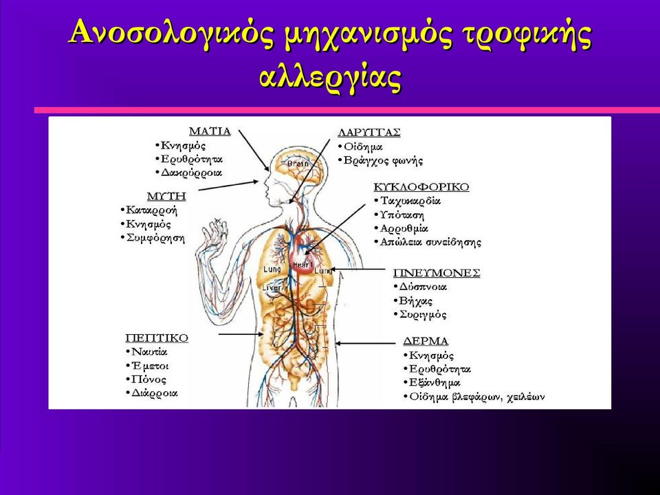 αλλεργιογόνου με αντισώματα IgE ΑΠΟΤΕΛΕΣ ΜΑ Ενεργοποίηση των