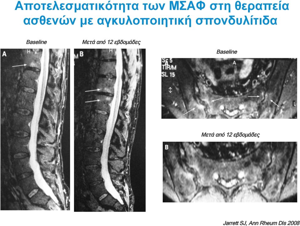 Baseline Μετά από 12 εβδοµάδες Baseline