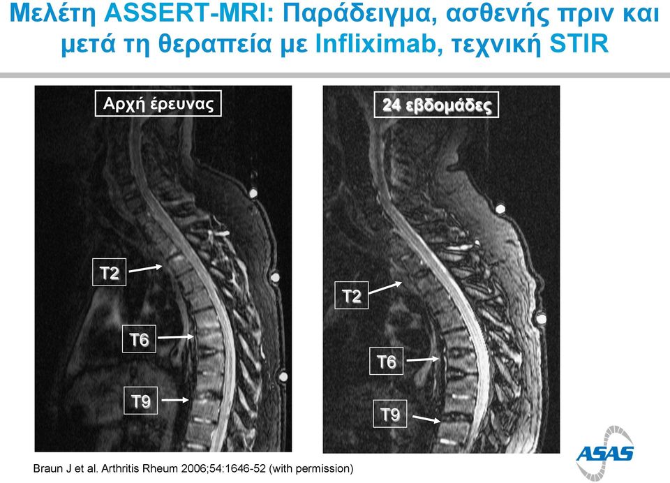 έρευνας 24 εβδοµάδες T2 T2 T6 T9 T6 T9 Braun J et