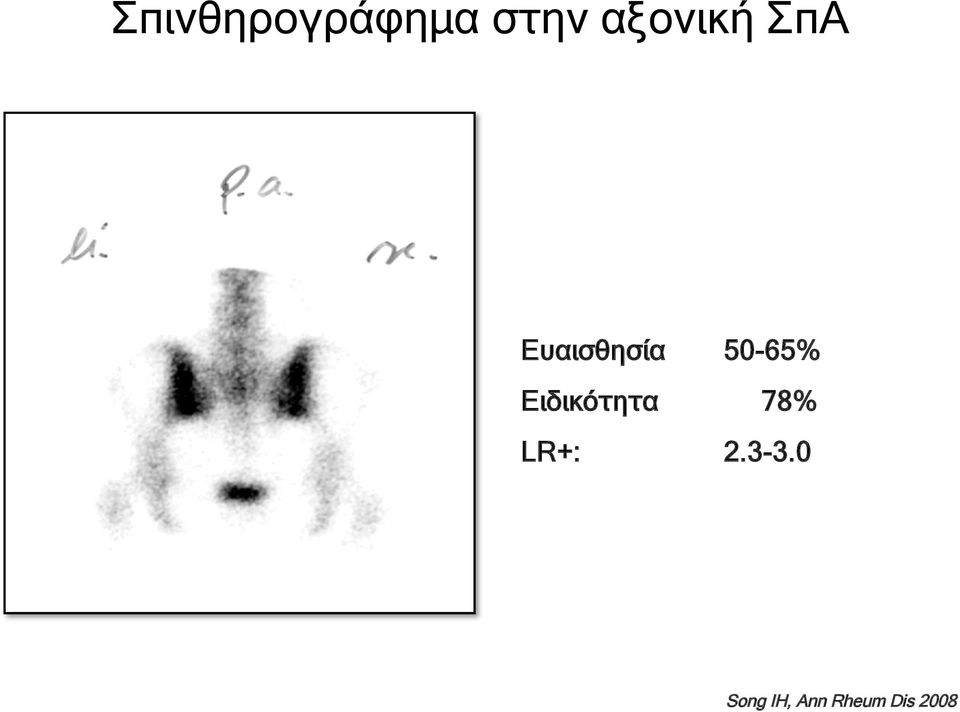 50-65% Ειδικότητα 78% LR+: