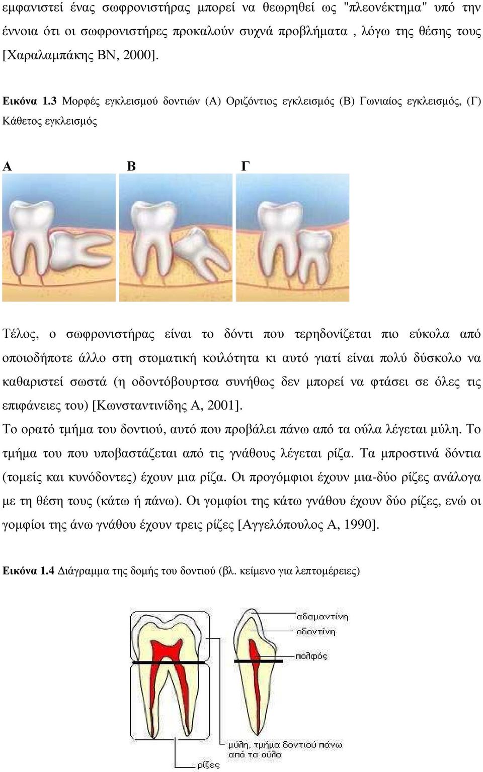 στοµατική κοιλότητα κι αυτό γιατί είναι πολύ δύσκολο να καθαριστεί σωστά (η οδοντόβουρτσα συνήθως δεν µπορεί να φτάσει σε όλες τις επιφάνειες του) [Κωνσταντινίδης Α, 2001].