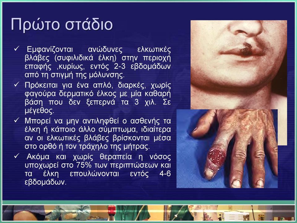 Σε μέγεθος.