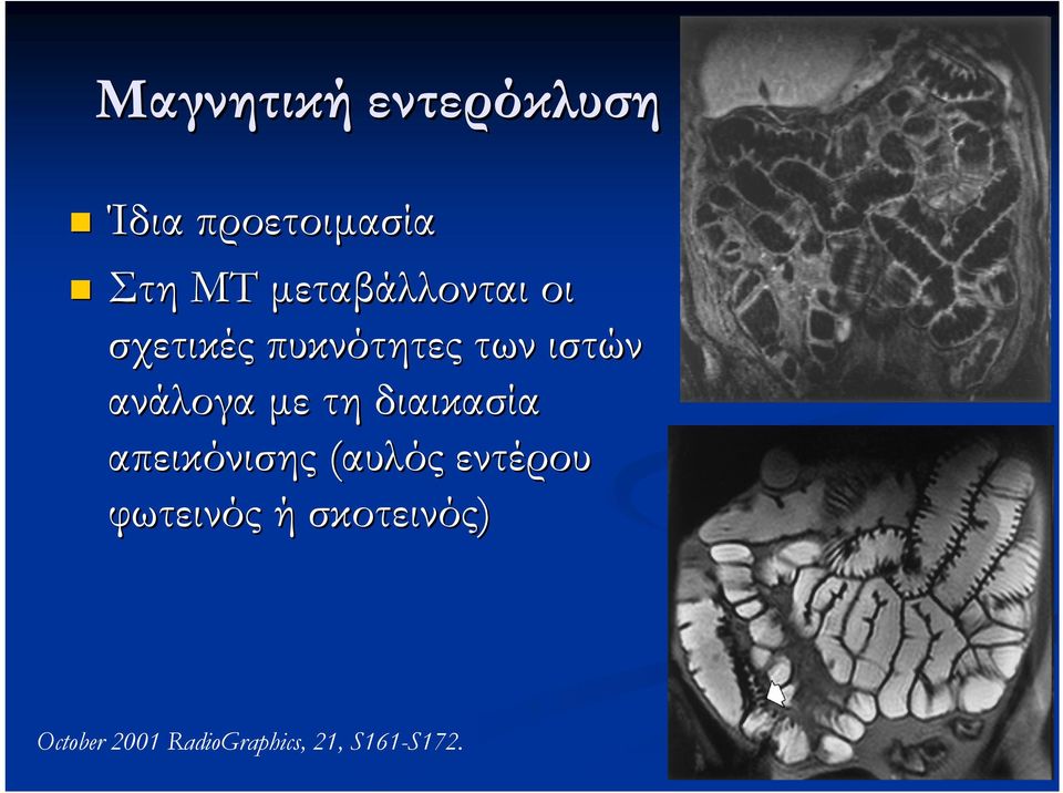 ανάλογα με τη διαικασία απεικόνισης (αυλός εντέρου
