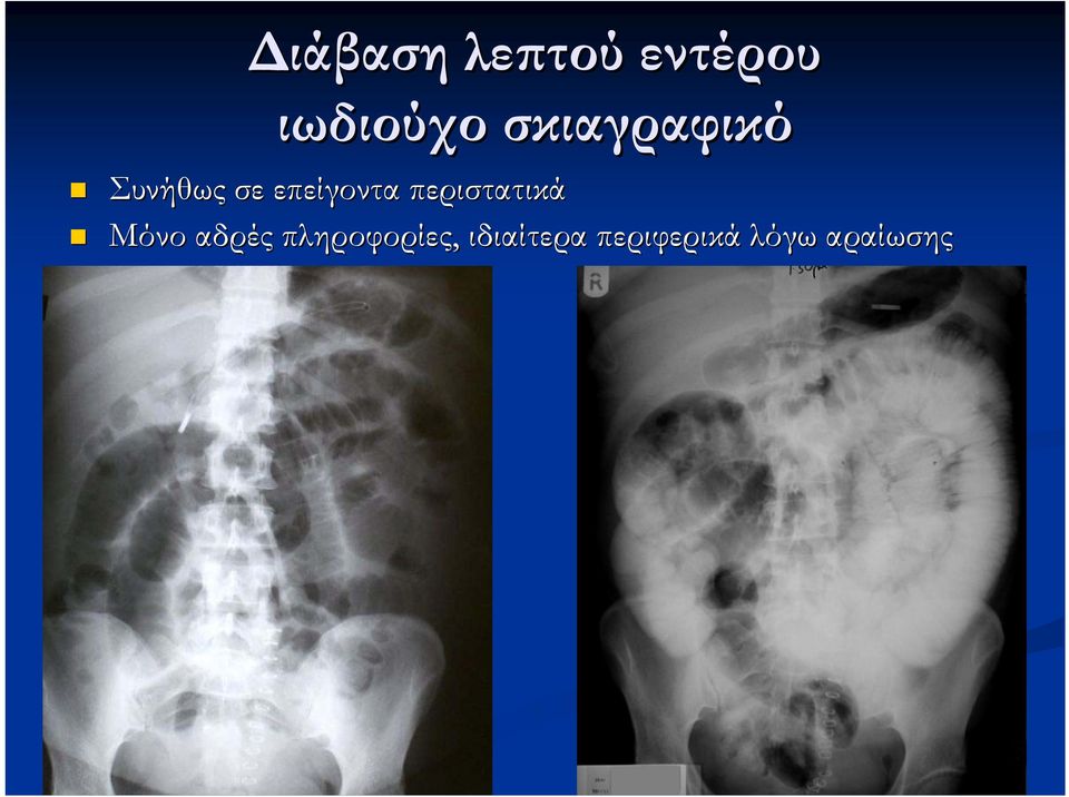 περιστατικά Μόνο αδρές