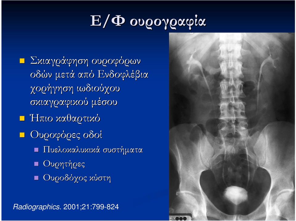 Ήπιο καθαρτικό Ουροφόρες οδοί Πυελοκαλυκικά