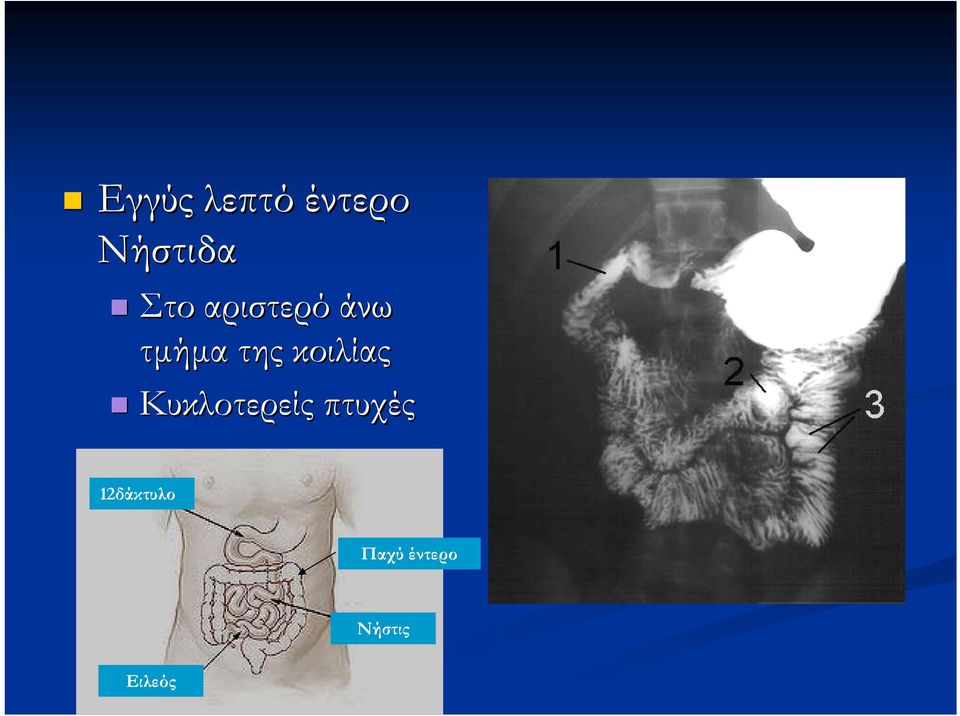 κοιλίας Κυκλοτερείς πτυχές