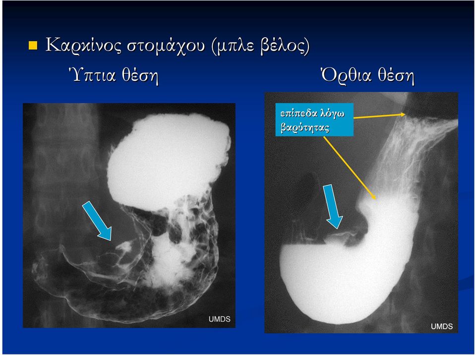 θέση Όρθια θέση