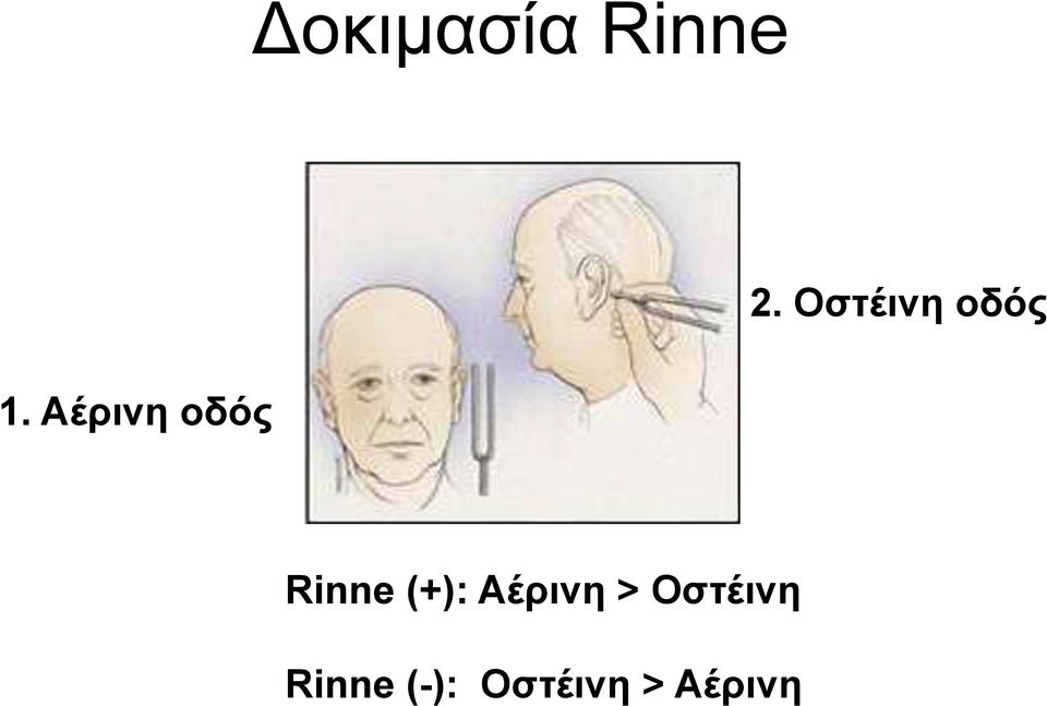 Αέρινη οδός Rinne (+):