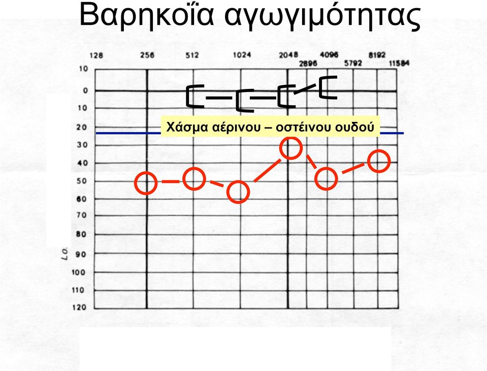 Χάσµα