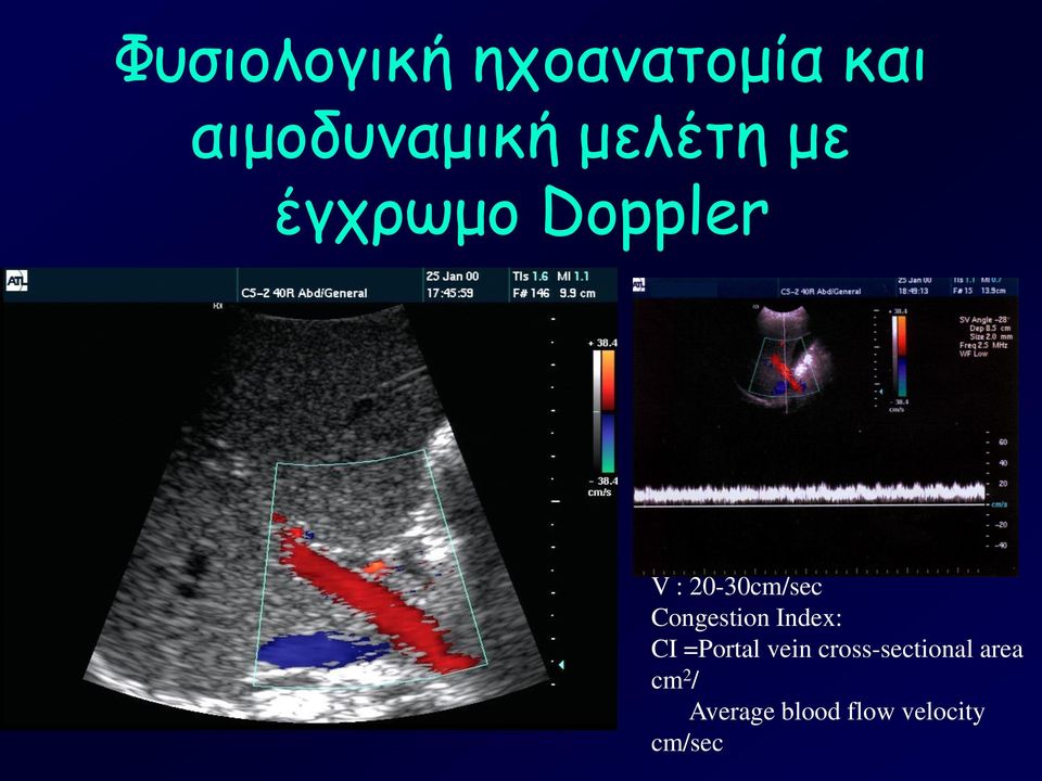 Congestion Index: CI =Portal vein