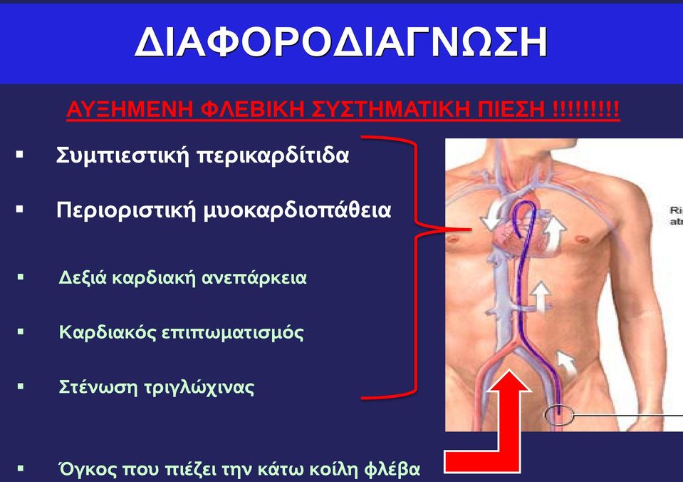 μυοκαρδιοπάθεια Δεξιά καρδιακή ανεπάρκεια Καρδιακός