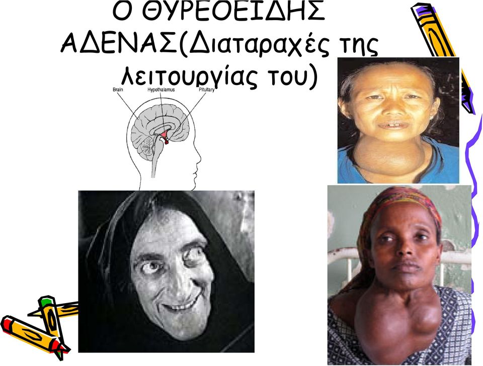 ιαταραχές