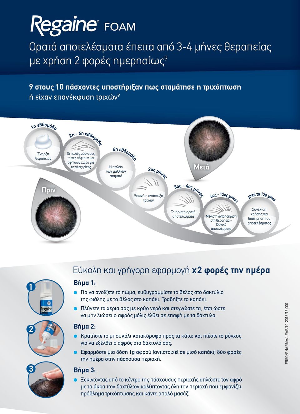 6ος - 12ος µήνα το 1 µετά 2ο µήνα ς Ξεκινά η ανάπτυξη τριχών 3ος - 4ος µή ν ας Πριν 6η εβδο µά δα Έναρξη θεραπείας Τα πρώτα ορατά αποτελέσµατα Μέγιστη ανταπόκριση στη θεραπεία Ιδανικά αποτελέσµατα