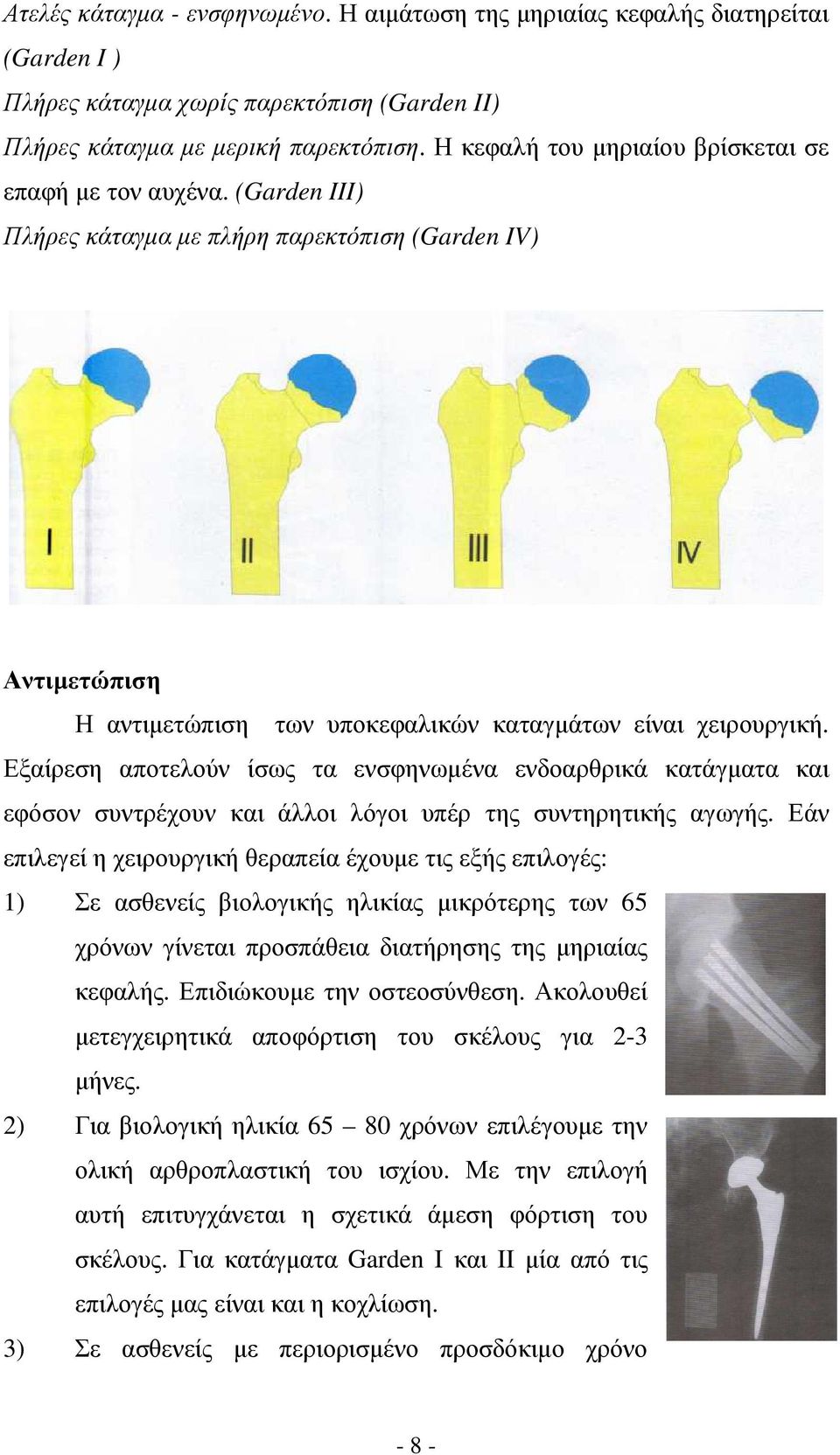 Εξαίρεση αποτελούν ίσως τα ενσφηνωµένα ενδοαρθρικά κατάγµατα και εφόσον συντρέχουν και άλλοι λόγοι υπέρ της συντηρητικής αγωγής.