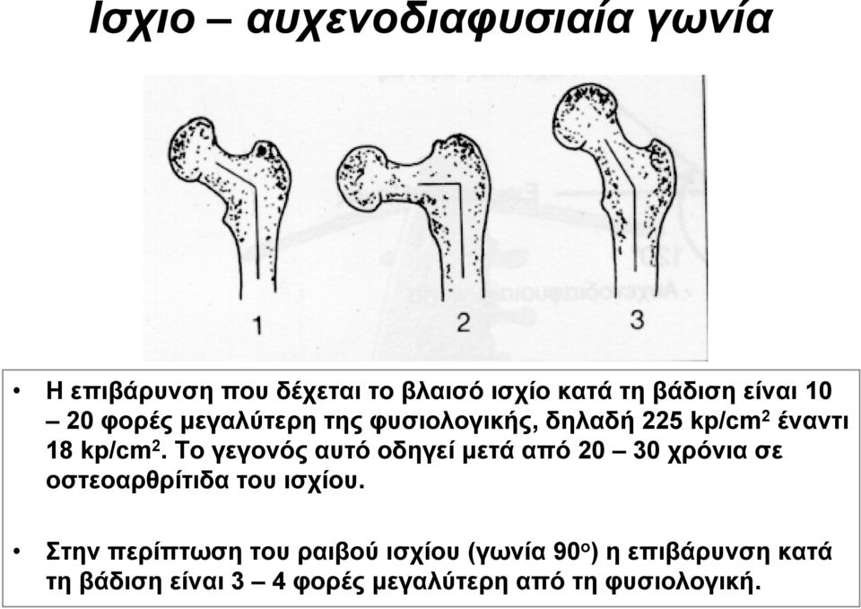 Το γεγονός αυτό οδηγεί μετά από 20 30 χρόνια σε οστεοαρθρίτιδα του ισχίου.