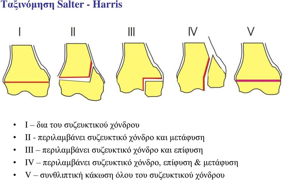 συζευκτικό χόνδρο και επίφυση IV περιλαμβάνει συζευκτικό