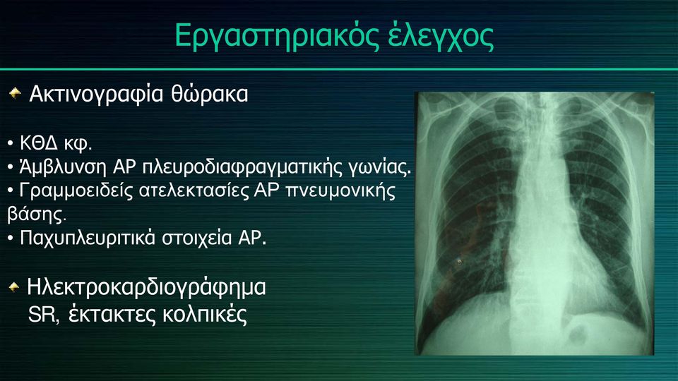 Γραμμοειδείς ατελεκτασίες ΑΡ πνευμονικής βάσης.