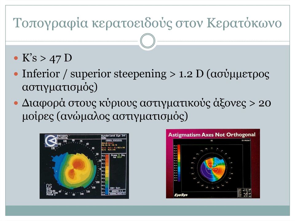 2 D (ασύµµετρος αστιγµατισµός) ιαφορά στους