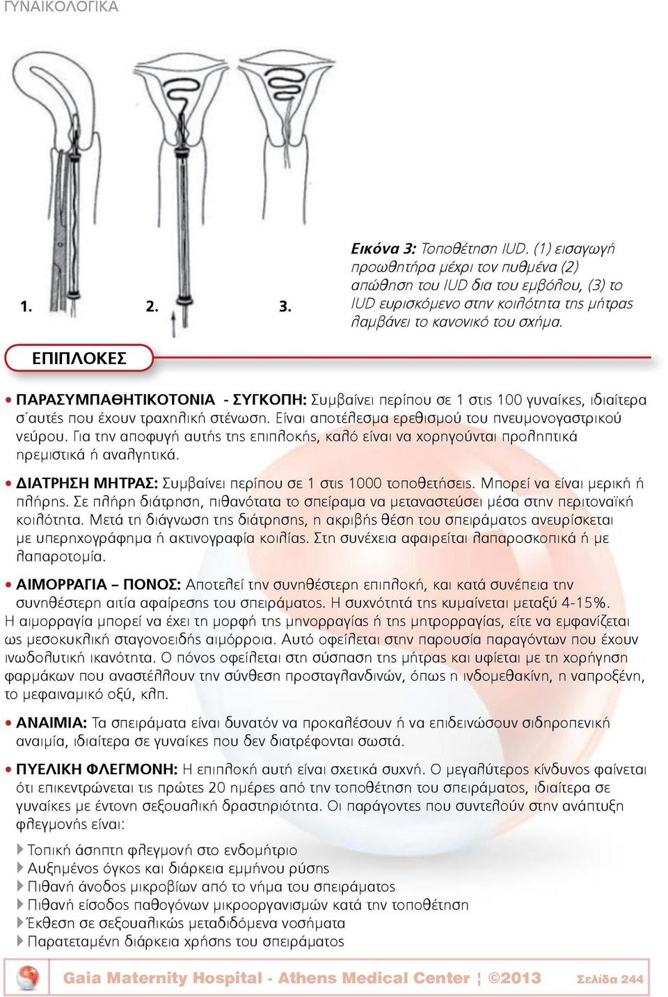 Για την αποφυγή αυτής της επιπλοκής, καλό είναι να χορηγούνται προληπτικά ηρεμιστικά ή αναλγητικά. ΔΙΑΤΡΗΣΗ ΜΗΤΡΑΣ: Συμβαίνει περίπου σε 1 στις 1000 τοποθετήσεις. Μπορεί να είναι μερική ή πλήρης.