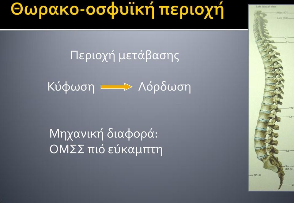 Λόρδωση Μηχανική