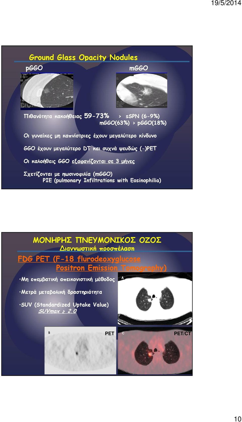 ηωσινοφιλία (mggo) PIE (pulmonary Infiltrations with Eosinophilia) Διαγνωστική προσπέλαση FDG PET (F-18 flurodeoxyglucose Positron